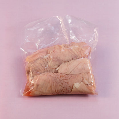 Large Intestines (Bituka)